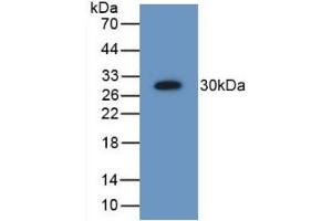 Detection of Recombinant PSMD9, Human using Polyclonal Antibody to Proteasome 26S Subunit, Non ATPase 9 (PSMD9) (Proteasome 26S Subunit, Non ATPase 9 (AA 2-223) Antikörper)