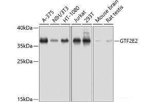 Western blot analysis of extracts of various cell lines using GTF2E2 Polyclonal Antibody at dilution of 1:1000. (GTF2E2 Antikörper)