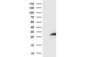 Image no. 4 for anti-Synovial Sarcoma, X Breakpoint 1 (SSX1) antibody (ABIN1501159) (SSX1 Antikörper)