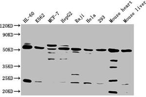 Western Blot Positive WB detected in: HL60 whole cell lysate, K562 whole cell lysate, MCF-7 whole cell lysate, HepG2 whole cell lysate, Raji whole cell lysate, Hela whole cell lysate, 293 whole cell lysate, Mouse heart tissue, Mouse liver tissue All lanes: NCR3LG1 antibody at 1:2000 Secondary Goat polyclonal to rabbit IgG at 1/50000 dilution Predicted band size: 51 kDa Observed band size: 51 kDa (B7-H6 Antikörper  (AA 25-262))