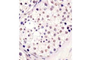 (ABIN6242809 and ABIN6578637) staining MLL3 in human testis tissue sections by Immunohistochemistry (IHC-P - paraformaldehyde-fixed, paraffin-embedded sections). (MLL3 Antikörper  (N-Term))