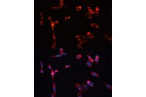 Immunofluorescence analysis of NIH/3T3 cells using MMP16 antibody (ABIN6132356, ABIN6143906, ABIN6143907 and ABIN6214654) at dilution of 1:100. (MMP16 Antikörper  (AA 290-565))