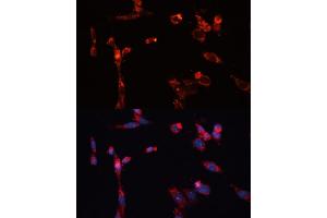 Immunofluorescence analysis of NIH/3T3 cells using MMP16 antibody (ABIN6132356, ABIN6143906, ABIN6143907 and ABIN6214654) at dilution of 1:100.
