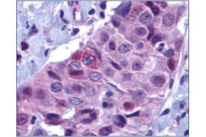 Image no. 1 for anti-BCL2 Binding Component 3 (BBC3) (N-Term) antibody (ABIN264889) (PUMA Antikörper  (N-Term))