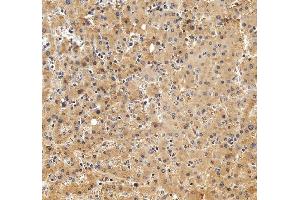 IHC analysis of Alpha 2-Antiplasmin/SERPINF2 using anti-Alpha 2-Antiplasmin/SERPINF2 antibody (ABIN7601808).