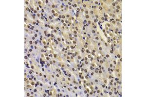 Immunohistochemistry of paraffin-embedded mouse kidney using FBXW7 antibody (ABIN5975397) at dilution of 1/100 (40x lens). (FBXW7 Antikörper)