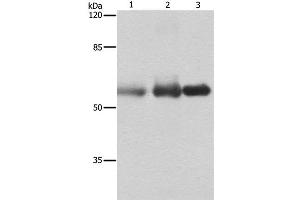 Western Blot analysis of Human cervical cancer, legs fibrous histiocytoma and fetal brain tissue using NECTIN1 Polyclonal Antibody at dilution of 1:400 (PVRL1 Antikörper)
