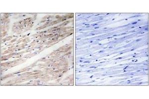 Immunohistochemistry analysis of paraffin-embedded human heart, using KIT (Phospho-Tyr936) Antibody. (KIT Antikörper  (pTyr936))