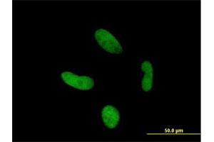 Immunofluorescence of purified MaxPab antibody to ZNF287 on HepG2 cell. (ZNF287 Antikörper  (AA 1-754))
