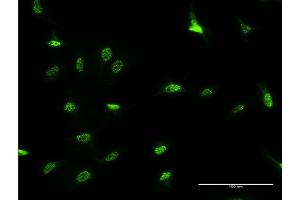 Immunofluorescence of monoclonal antibody to DLX3 on HeLa cell. (DLX3 Antikörper  (AA 1-287))