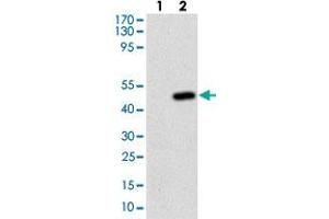 Western blot analysis of Lane 1: Negative control [HEK293 cell lysate]; Lane 2: Over-expression lysate [FTL (AA: 1-175)-hIgGFc transfected HEK293 cells] with FTL monoclonal antibody, clone 6E10E4  at 1:500-1:2000 dilution. (FTL Antikörper)