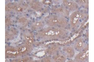 DAB staining on IHC-P; Samples: Rat Kidney Tissue (S100 Protein (S100) (AA 1-94) Antikörper)