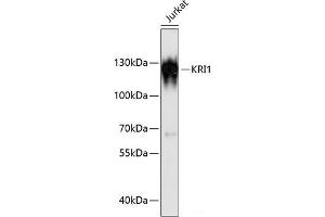 Western blot analysis of extracts of Jurkat cells using KRI1 Polyclonal Antibody at dilution of 1:3000. (KRI1 Antikörper)
