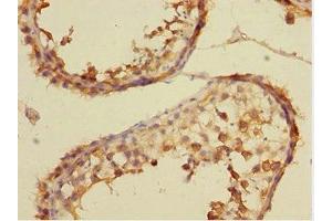 Immunohistochemistry of paraffin-embedded human testis tissue using ABIN7149072 at dilution of 1:100 (CSRNP2 Antikörper  (AA 324-543))