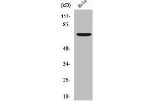 Western Blot analysis of Hela cells using Frizzled-1 Polyclonal Antibody (FZD1 Antikörper  (N-Term))