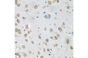 Immunohistochemistry of paraffin-embedded mouse brain using GNE antibody at dilution of 1:100 (x40 lens).