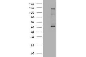 Western Blotting (WB) image for anti-alpha-1,4-N-Acetylglucosaminyltransferase (A4GNT) (AA 121-340) antibody (ABIN1490881)