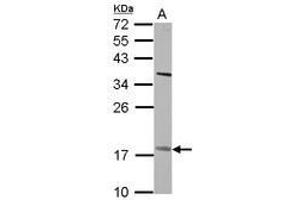 Image no. 2 for anti-Patatin-Like phospholipase Domain Containing 4 (PNPLA4) (AA 1-249) antibody (ABIN1500317) (PNPLA4 Antikörper  (AA 1-249))