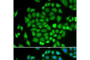 Immunofluorescence analysis of HeLa cells using AKR7A2 Polyclonal Antibody (AKR7A2 Antikörper)
