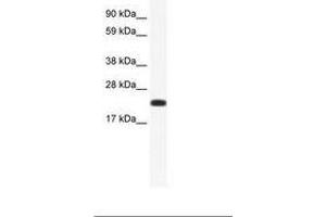 Image no. 1 for anti-Cbp/p300-Interacting Transactivator, with Glu/Asp-Rich Carboxy-terminal Domain, 4 (CITED4) (AA 31-80) antibody (ABIN202045) (CITED4 Antikörper  (AA 31-80))