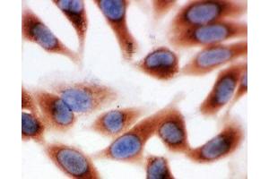 ICC testing of HeLa cells (CAPN1 Antikörper  (Middle Region))