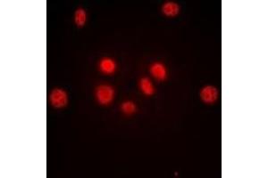 Immunofluorescent analysis of c-Jun staining in HeLa cells. (C-JUN Antikörper)