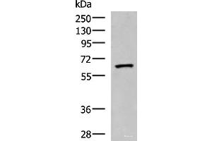 Western blot analysis of Human placenta tissue lysate using PDIA5 Polyclonal Antibody at dilution of 1:1000 (PDIA5 Antikörper)