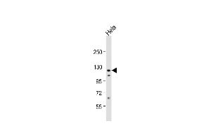 Anti-VINC Antibody (C-term) at 1:1000 dilution + Hela whole cell lysate Lysates/proteins at 20 μg per lane. (Vinculin Antikörper  (C-Term))