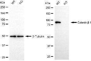 Western blotting analysis using catenin beta 1 antibody (ABIN7797925).