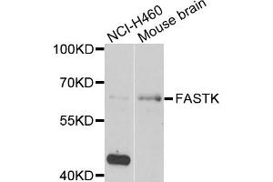 Western blot analysis of extracts of NCI-H460 and mouse brain cells, using FASTK antibody. (FASTK Antikörper)
