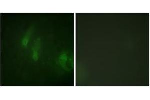Immunofluorescence analysis of HeLa cells, using FANCA (Phospho-Ser1149) Antibody. (FANCA Antikörper  (pSer1149))