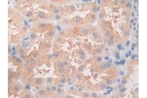 DAB staining on IHC-P; Samples: Human Kidney Tissue (ANGPTL5 Antikörper  (AA 141-383))