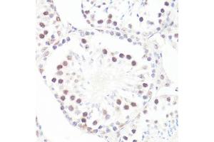 Immunohistochemistry of paraffin-embedded mouse testis using P-MYC-S62 antibody (ABIN3019544, ABIN3019545, ABIN3019546 and ABIN6225456) at dilution of 1:100 (40x lens). (c-MYC Antikörper  (pSer62))