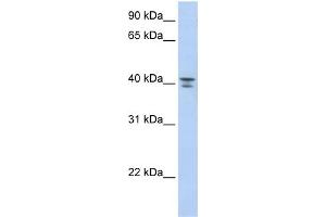 WB Suggested Anti-GNA12 Antibody Titration: 0. (GNA12 Antikörper  (Middle Region))