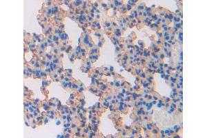 Used in DAB staining on fromalin fixed paraffin- embedded lung tissue (ABCA8 Antikörper  (AA 1303-1514))