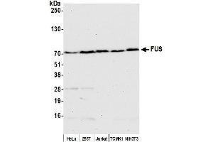 Western Blotting (WB) image for anti-Fused in Sarcoma (FUS) (AA 1-50) antibody (ABIN7454969) (FUS Antikörper  (AA 1-50))