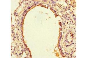 Immunohistochemistry of paraffin-embedded human lung tissue using ABIN7169807 at dilution of 1:100 (SLITRK6 Antikörper  (AA 621-821))