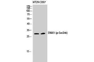 Western Blotting (WB) image for anti-SNAIL (SNAI1) (pSer246) antibody (ABIN3182456) (SNAIL Antikörper  (pSer246))