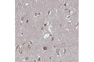 ABIN6266655 at 1/100 staining human brain tissue sections by IHC-P.