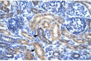 Human kidney; Rabbit Anti-OR13C9 Antibody. (OR13C9 Antikörper  (Middle Region))