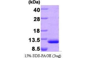SDS-PAGE (SDS) image for Chemokine (C-C Motif) Ligand 22 (CCL22) (AA 25-93) protein (His tag) (ABIN666666)