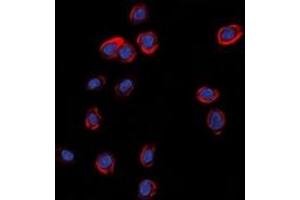 Immunofluorescent analysis of GLUR1 staining in A549 cells. (Glutamate Receptor 1 Antikörper  (C-Term))