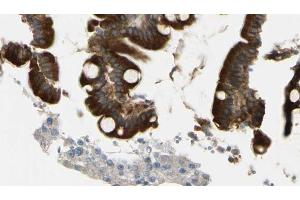 ABIN6269264 at 1/100 staining Mouse intestine tissue by IHC-P. (Crk Antikörper)
