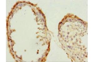 Immunohistochemistry of paraffin-embedded human testis tissue using ABIN7147293 at dilution of 1:100 (CDC7 Antikörper  (AA 275-574))