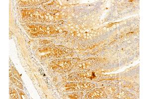 ABIN6255513 and ABIN6267630 at 1/100 staining Rat colon tissue by IHC-P. (Acetyl-CoA Carboxylase alpha Antikörper  (pSer79, pSer80))