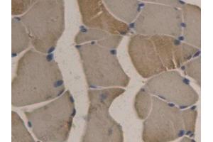 DAB staining on IHC-P; Samples: Rat Skeletal muscle Tissue (APOB Antikörper  (AA 2747-2913))