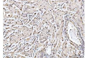 IHC analysis of RAE1 using anti-RAE1 antibody (ABIN7602428). (RAE1 Antikörper  (AA 76-368))