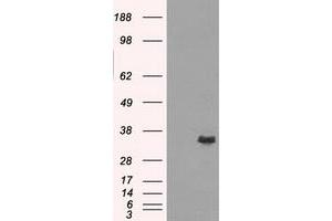 Image no. 3 for anti-Aldo-Keto Reductase Family 1, Member A1 (Aldehyde Reductase) (AKR1A1) antibody (ABIN1496542) (AKR1A1 Antikörper)