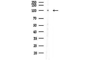 anti-TBC1 Domain Family, Member 2 (TBC1D2) (N-Term) antibody