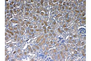 IHC analysis of CD151 using anti- CD151 antibody . (CD151 Antikörper  (AA 113-175))